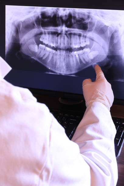 Best Emergency Tooth Extraction in Cochran, GA