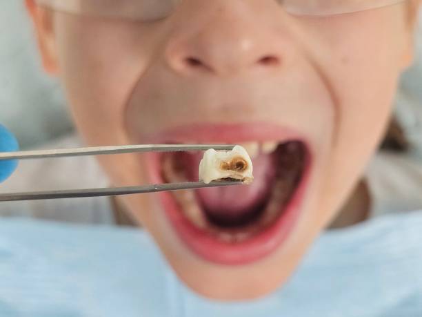 Best Walk-In Emergency Dentist in Cochran, GA