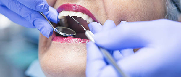 Best Emergency Wisdom Teeth Removal in Cochran, GA